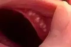                     宝爸宝妈别再乱担心了，宝宝的这28种情况是正常的噢
