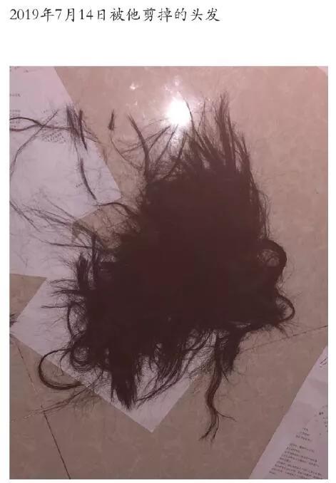 剃头发掰断手指强迫发生关系女友受伤照片太吓人这不是男友是禽兽啊