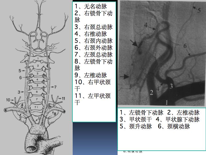 神经解剖| 脑及颈部血管造影图谱