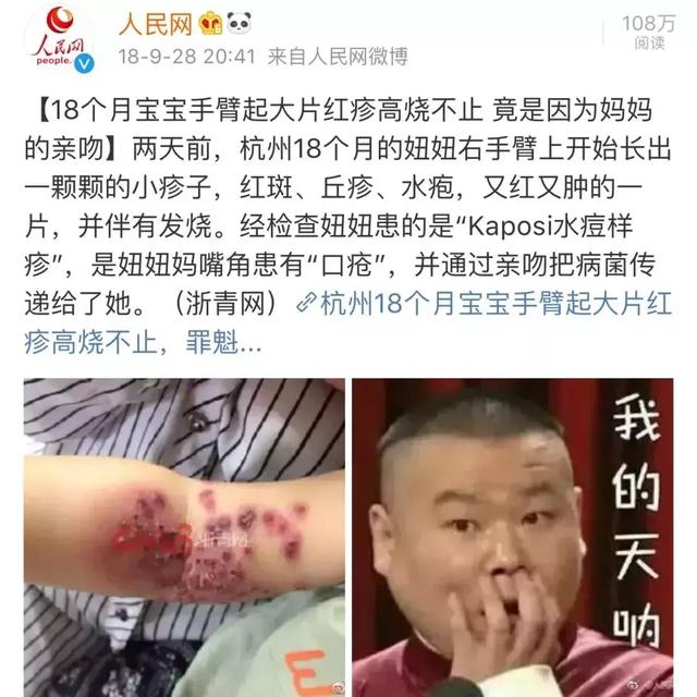                     一个宝宝被亲出事，请不要随便亲吻我的孩子