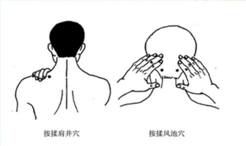 落枕有奇招教你远离落枕的痛苦