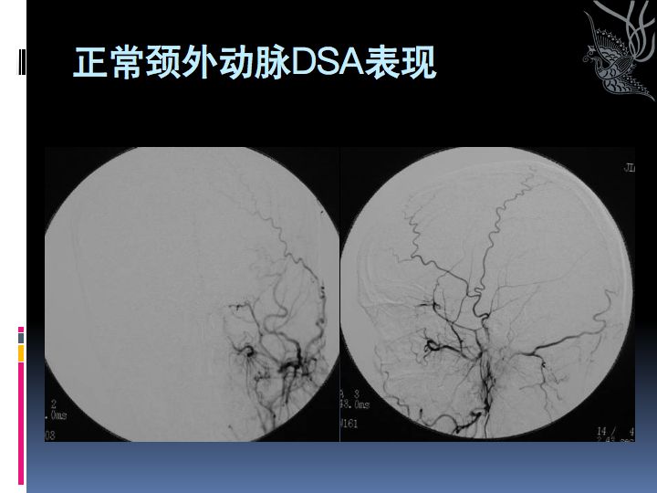 神经解剖| 脑及颈部血管造影图谱