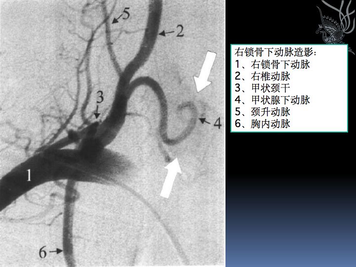 神经解剖| 脑及颈部血管造影图谱