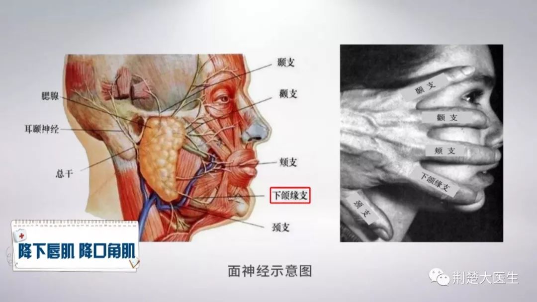 穿过腮腺深部,最后发出5个面神经分支:颞支,颧支,颊支,下颌缘支,颈支