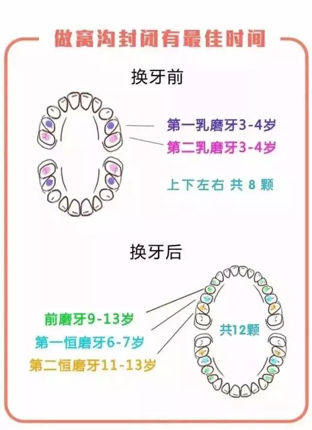 几个月开始涂氟 e7fb8a917afc490fadeb01713b643f2d.jpeg