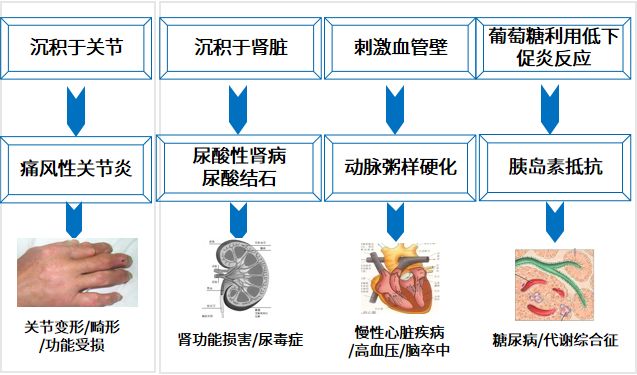 无症状高尿酸血症要不要治疗