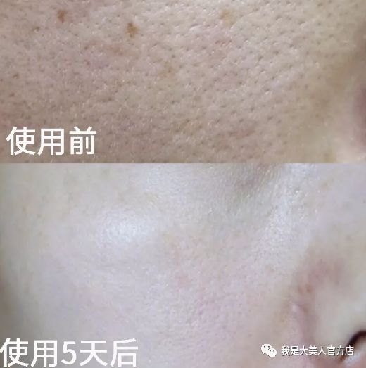 吴昕 徐璐最爱的这个大牌又发大招了 新出的这款熬夜神器 睡一觉 脸蛋又v又嫩 还去皱 秋瓷