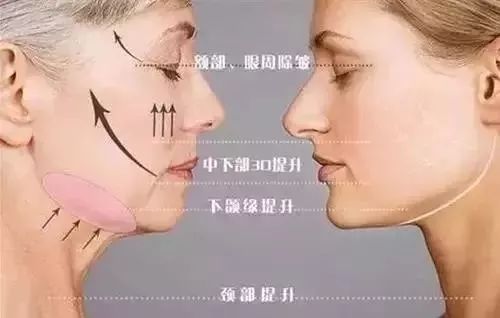 怎么改善法令纹下垂问题 14d1daadcdd647d5919daabd1a8e6636.jpeg