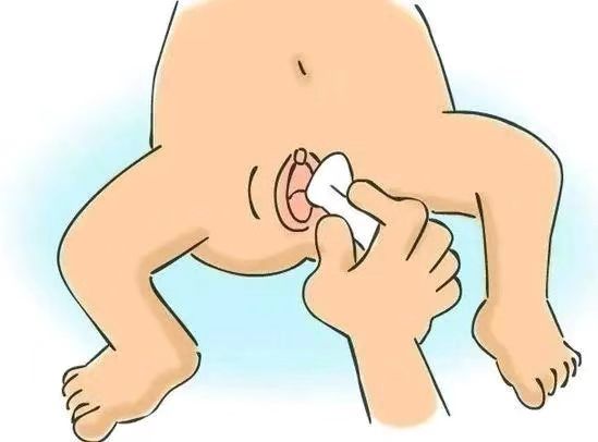 如何给宝宝换纸尿裤洗屁屁 1bdd87b6fe0244df858f39df75014616.jpeg