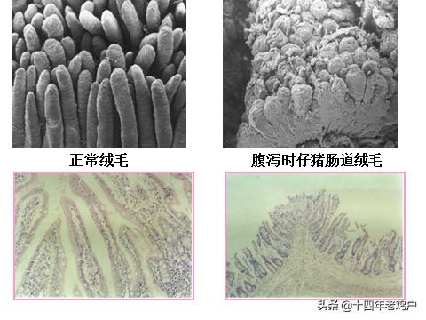 肠道屏障出现损伤后,大量致病菌趁虚而入,引发机体免疫系统剧烈应答