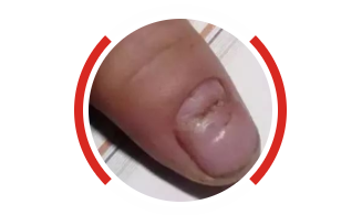 怎么能让指甲变得细长 ebd6d7c492df4209971c7f092436906c.png