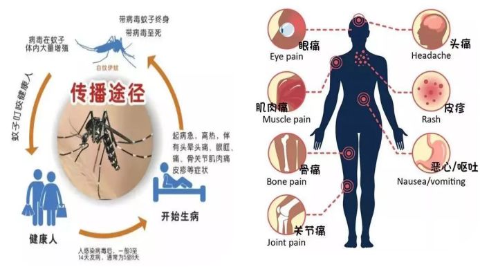 登革热怎么引起的 来自搜狐网