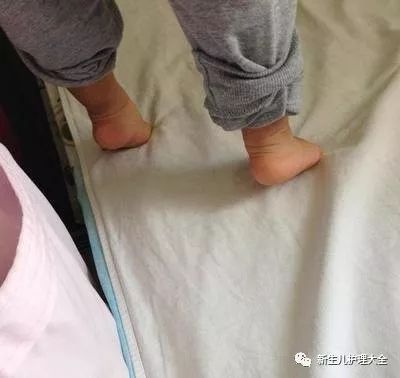                     宝宝喜欢用足尖走路，如何纠正？