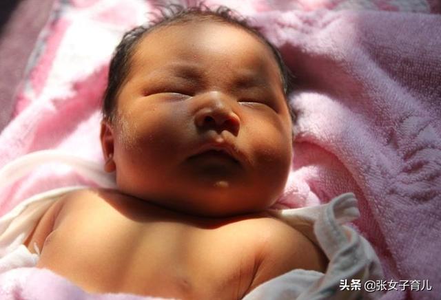                     新生儿出现黄疸，就不能母乳喂养了么？儿科医生这样回答