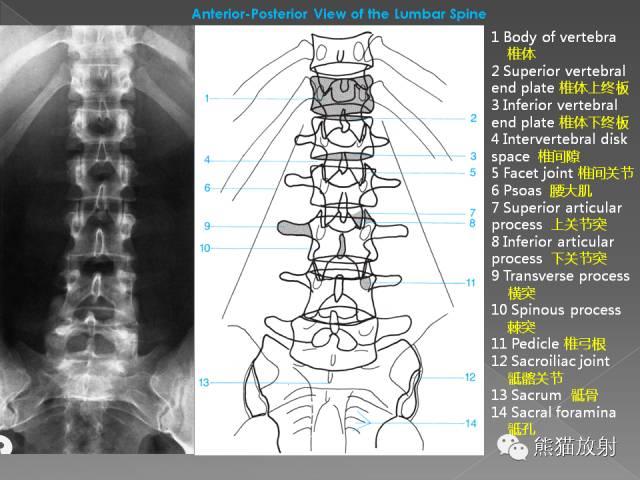 推荐| 详细的腰椎x线解剖及解读
