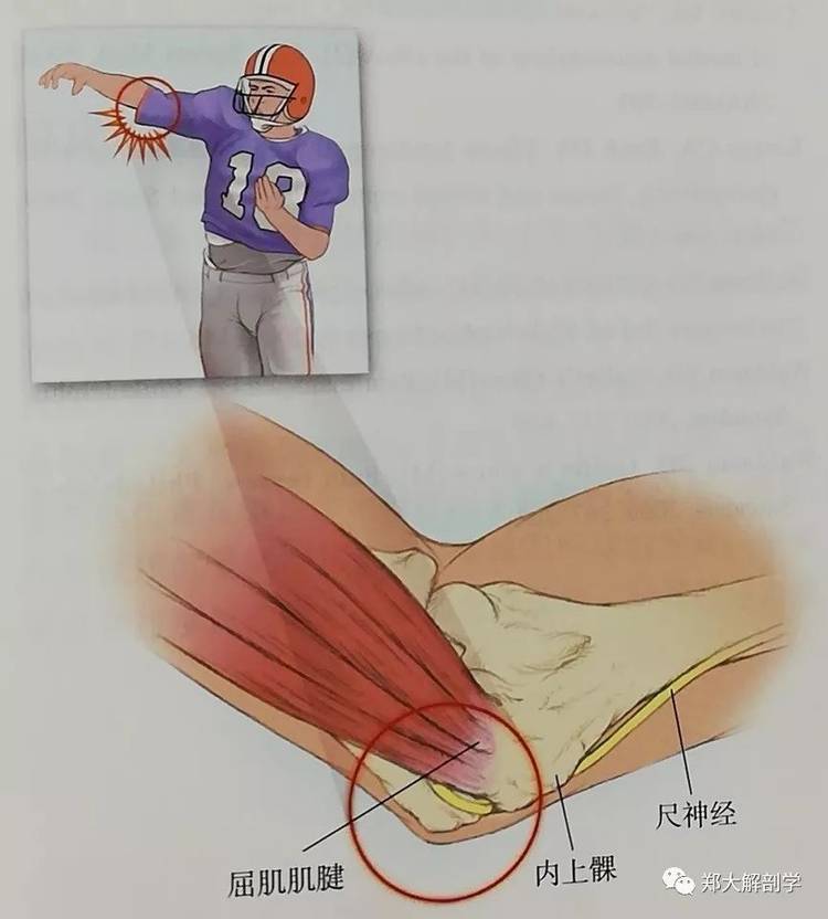 六种引起肘关节的疼痛综合征Ⅰ