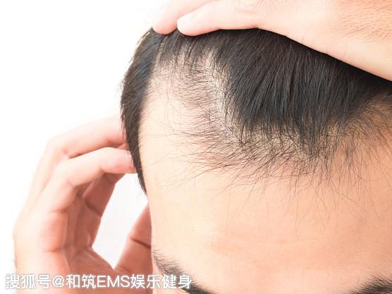 脱发跟健身有关系吗?