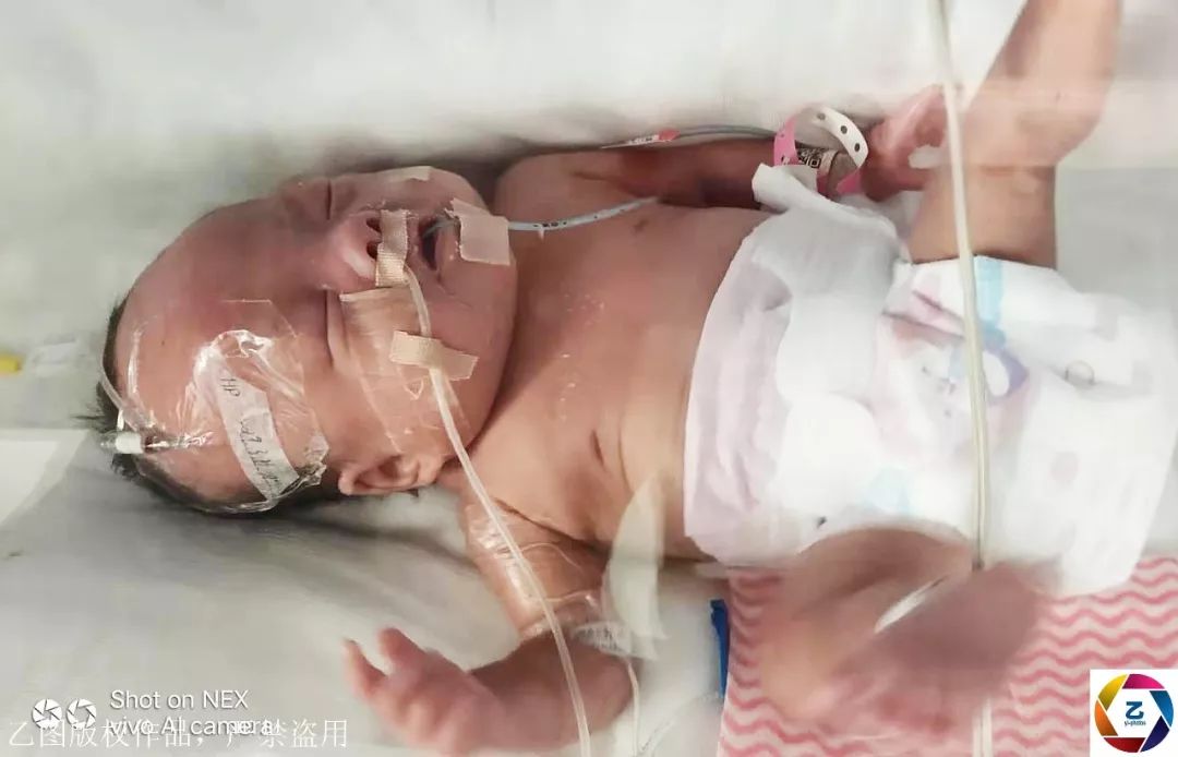 早产大头宝宝生命垂危被推进ICU抢救年轻爸妈跪地泣不成声(图3)