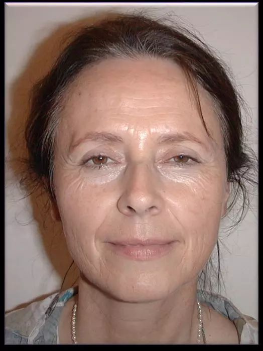 多少岁开始抗衰老 493bdb9879be464ab8f992420bb7e6ce.jpeg