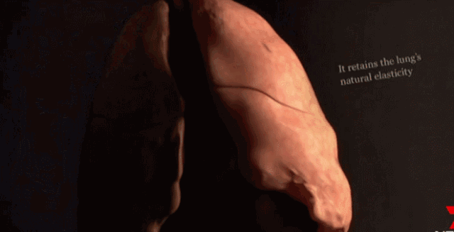 571434aa21ce40c89ba5ad91322a4a39.gif