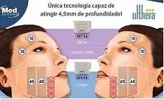 5c26cb3ad66144ffb60e0d60b09ed161.JPG