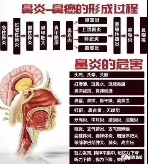 鼻炎和感冒你分得清吗鼻炎久拖不治危险大宜丰人可以免费检查鼻腔啦