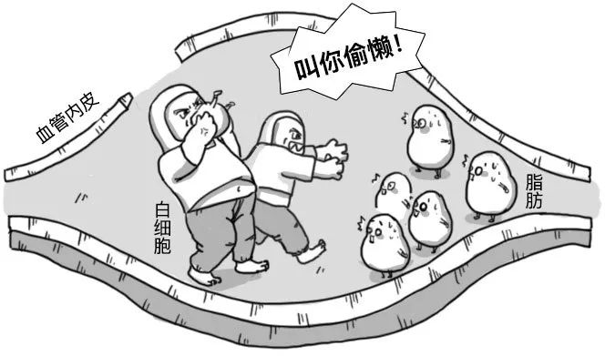 人口堵塞_血管堵塞图片(2)