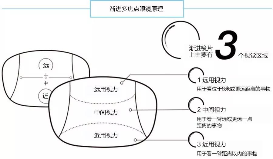 做眼睛近视手术的原理_做近视手术前必须要做眼部检查,医生根据检查的结果,评估你是否适合(2)