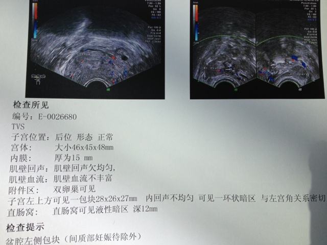 如果停经了怎么办