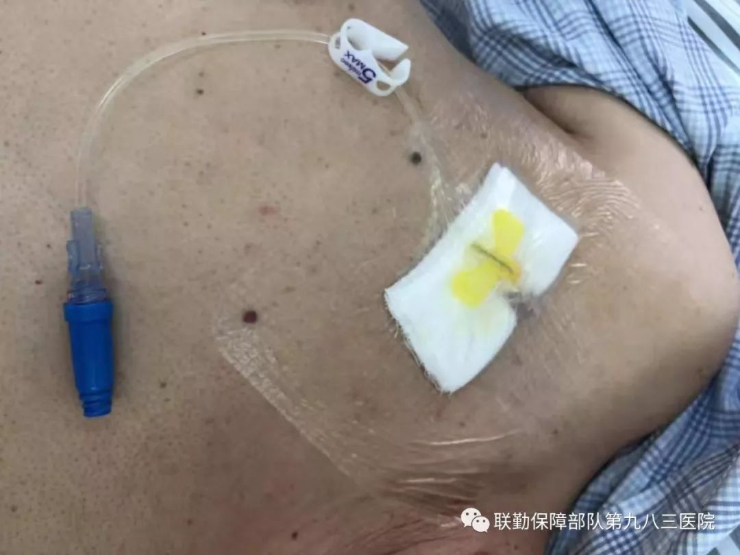 输液部位又红又肿？背后原因真没想到 ... ..._医学界-助力医生临床决策和职业成长