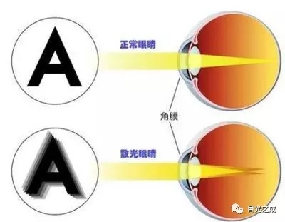 散光什么成语_散光是什么症状(3)
