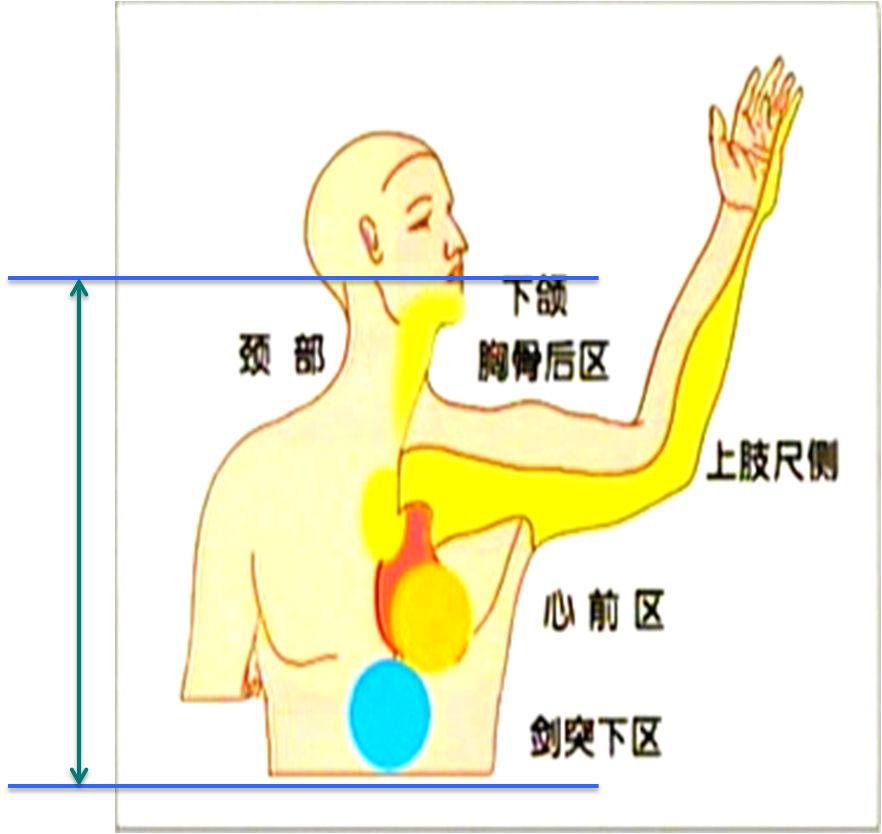 冠心病是如何被确诊的看完这篇你就知道了