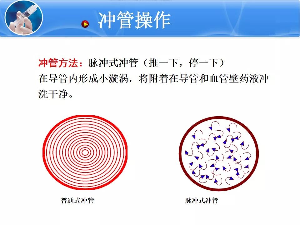 ppt告诉你中心静脉导管维护冲管与封管