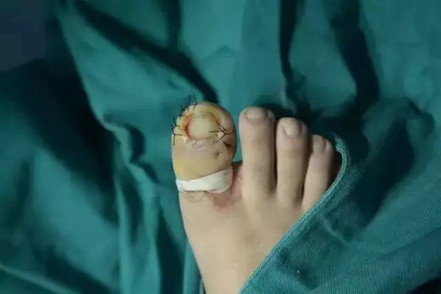 你剪了大半辈子的指甲,居然剪错了!