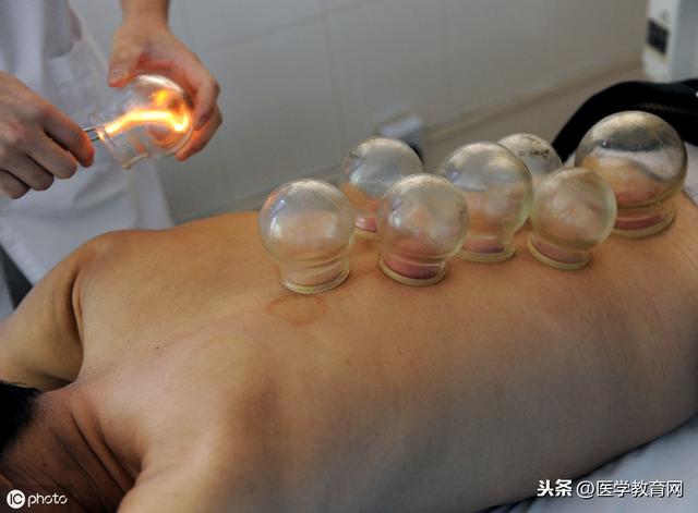 拔罐为啥拔不紧 ed49838e94b3428ca7f50ed4a50f83b3.jpeg
