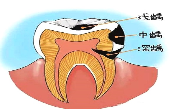牙医牙痛猜一成语_牙痛的图片表情图片(2)