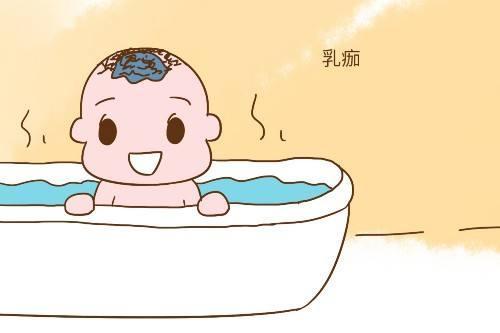                     新生儿身上8个看起来不正常的正常现象，看看你家宝宝有几个？