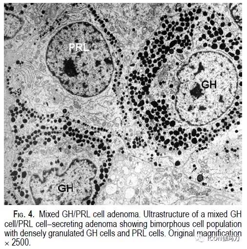 生长激素的分泌与什么有关 371a2c72be614dad87a2ba6ffc065603.jpeg