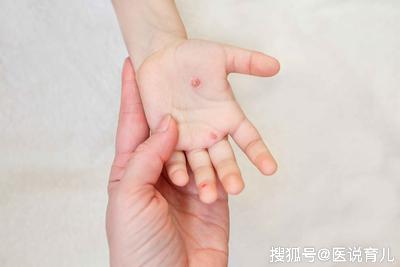                     原创            一定要教孩子养成讲卫生的好习惯，怎么做可预防疾病