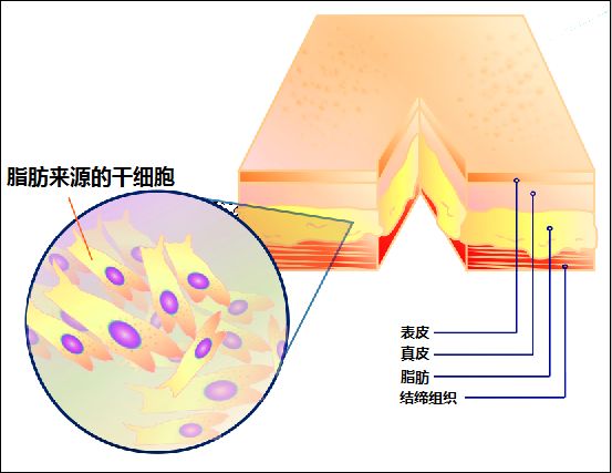 美人之迟暮脂肪干细胞成明星