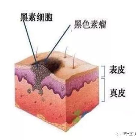 76f63718a4ed4b89ab2c1716f1a81614.jpeg