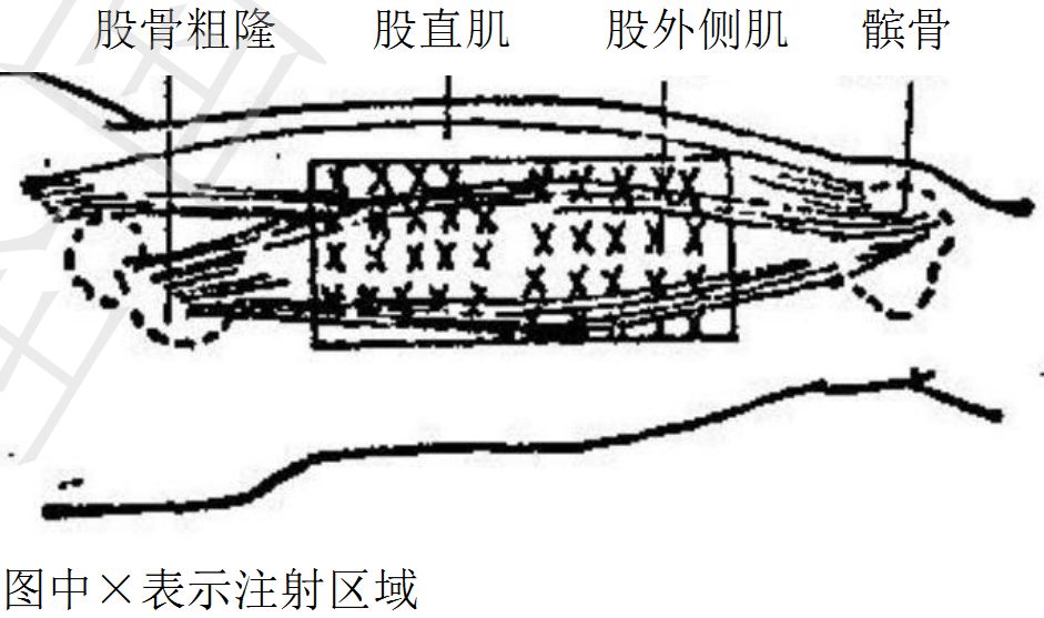 三,注射部位及注射深度 肾上腺素首选股外侧肌注射,下图较为直观.