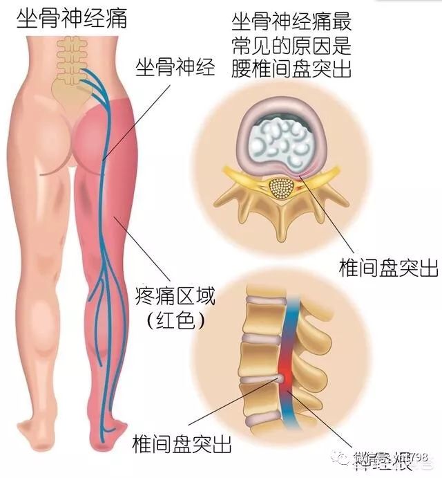 下肢发凉怎么办