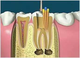 牙齿修复是什么意思