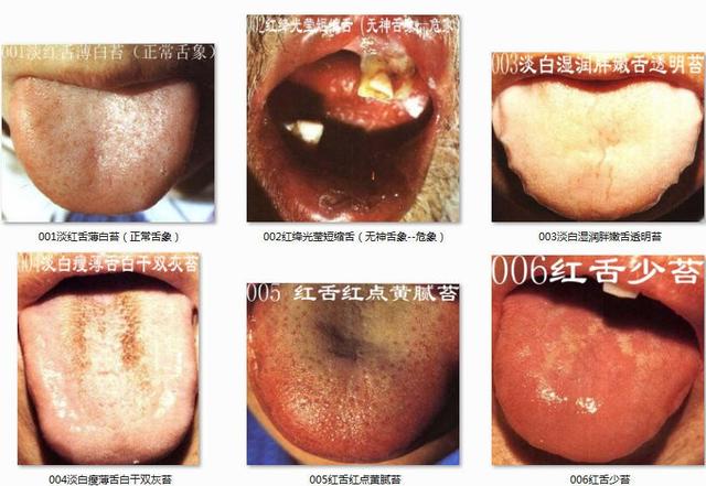 舌诊大全1舌象及图谱主病治法方药