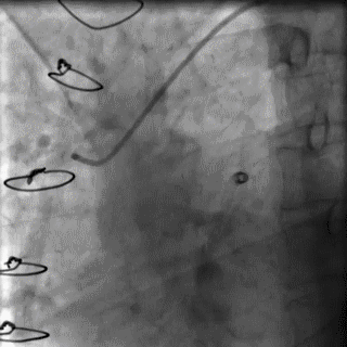 a334a156e1274e2b86fe99719ceed1a3.gif