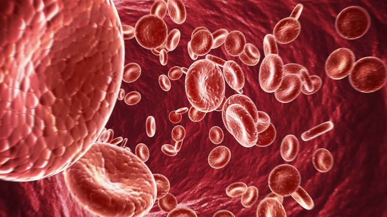 什么是动脉粥样硬化的标准 45425ea1bc55498ca1faaed29348a5c2.jpeg