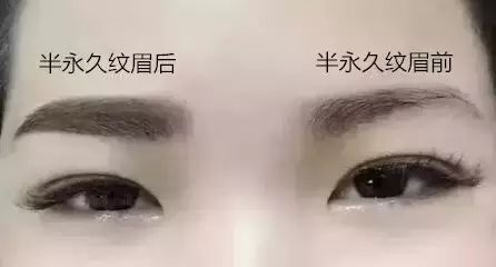 460595b8ff9a494e822d0a7f81625de8.jpeg