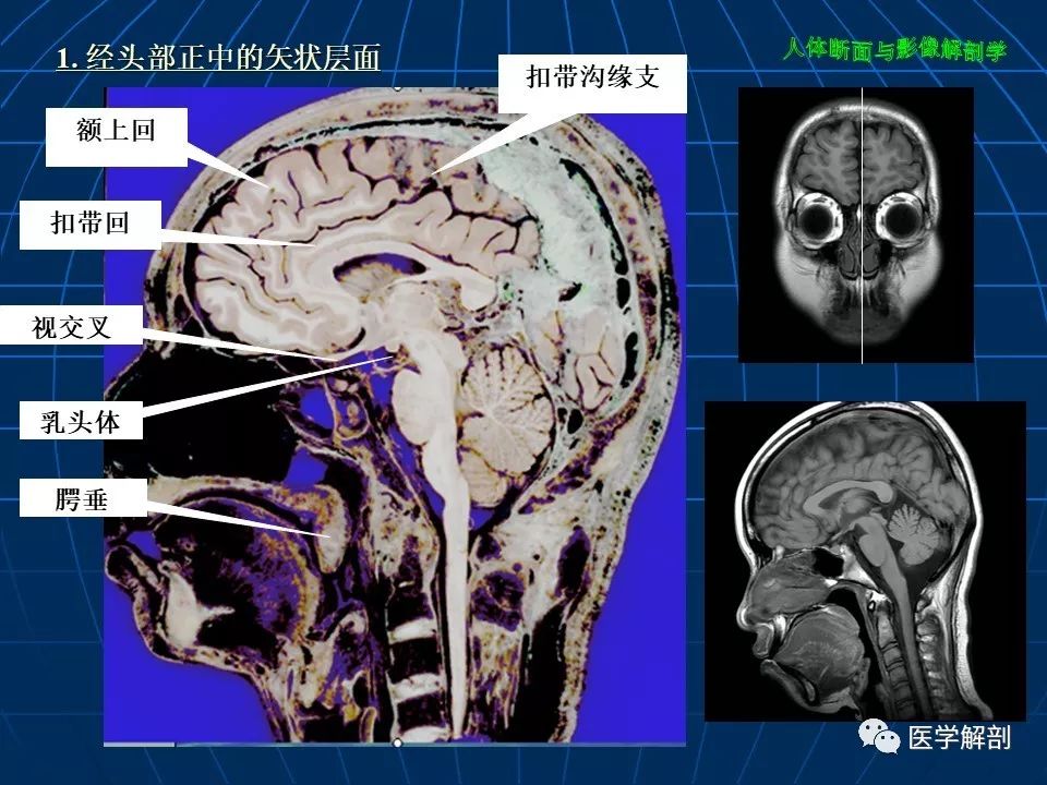 颅脑大体断层解剖(矢状位)