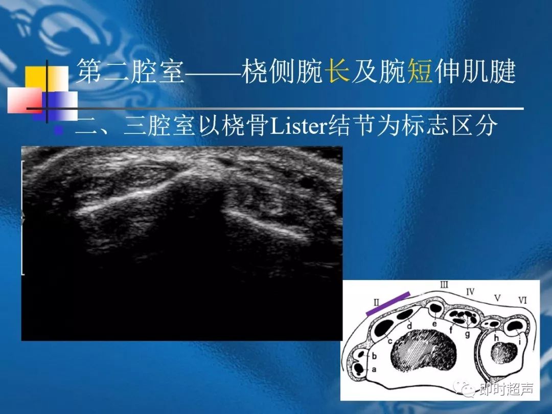 手腕部超声检查